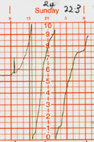 Rainfall chart at Llansadwrn for 24-h ending 25 Oct 99 (15.5KB)
