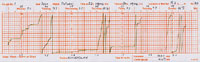Click for larger version of autographic record of rainfall during the week 23-29 October 2000.