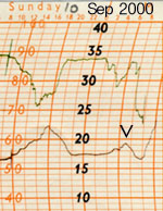 Llansadwrn: Autographic chart for the 10/11 September 2000. Time-marked 0900 GMT, RH is set 2h early. 